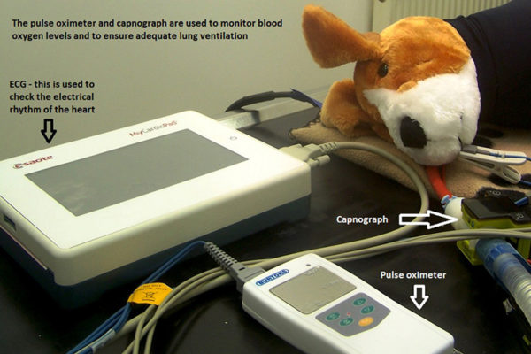 Anaesthetic Monitoring