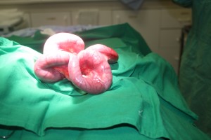 Pyometra uterus removed from a 16 lbs dog